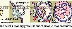 Kembar Kembar Kembar 5 Pdf